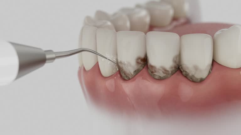 Trusted Teeth Cleaning And Checkup service in Brookfield, MO - Dentist Open Now